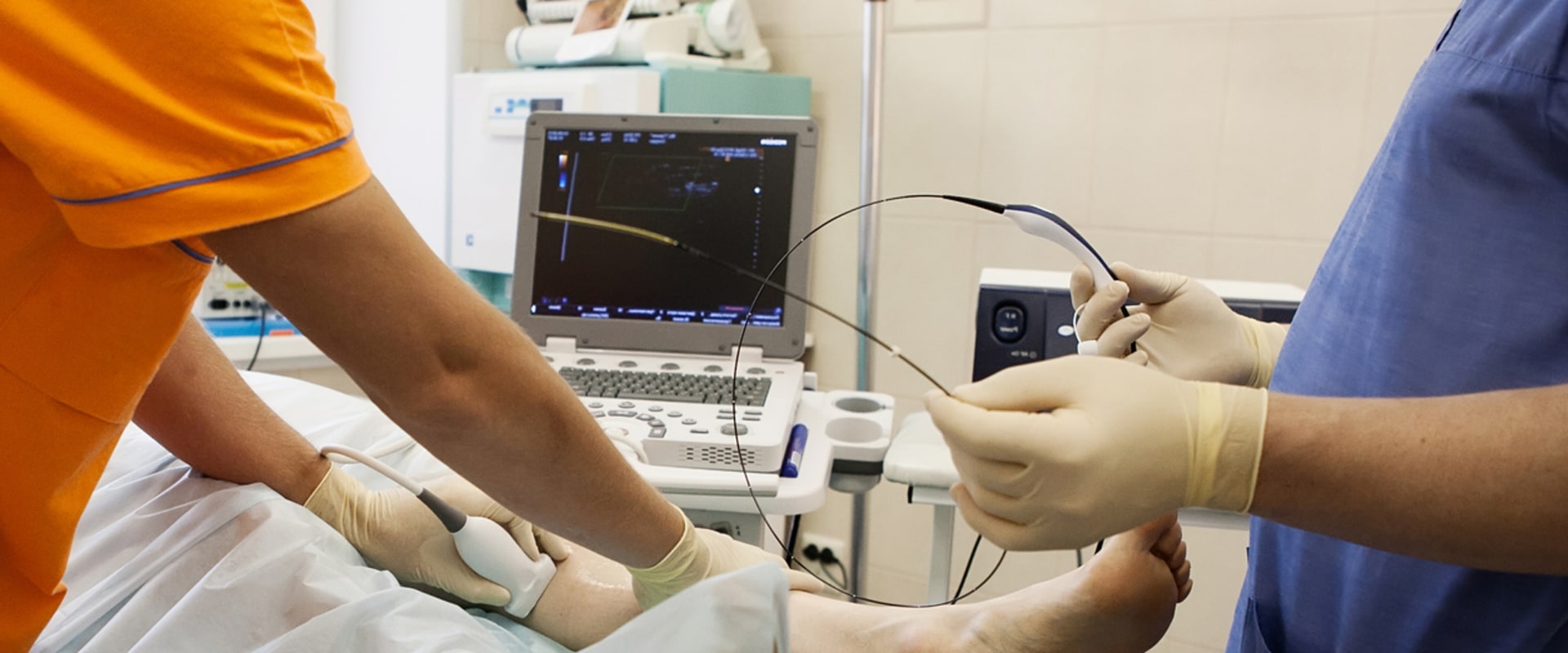 Success Rate of Radiofrequency Ablation Treatment for Vein Diseases in St. Louis, Missouri