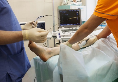 Success Rate of Radiofrequency Ablation Treatment for Vein Diseases in St. Louis, Missouri